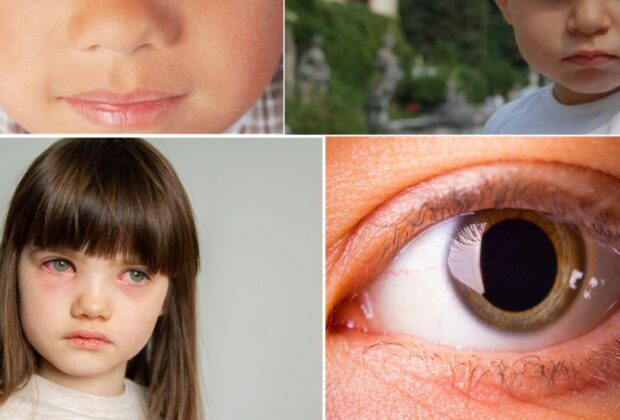 Privirea copilului tău îți poate spune mai multe decât crezi: ce boli grave poți depista din ochi