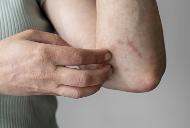 Intervenție de urgență la un colegiu național din Sibiu: Zeci de elevi au acuzat mâncărimi de piele