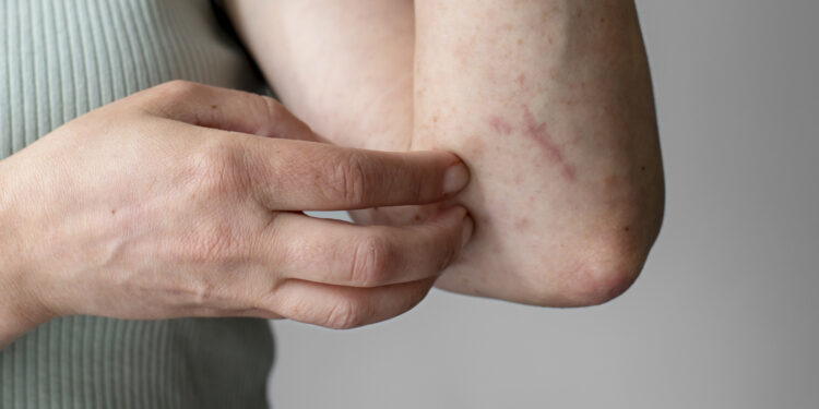 Intervenție de urgență la un colegiu național din Sibiu: Zeci de elevi au acuzat mâncărimi de piele