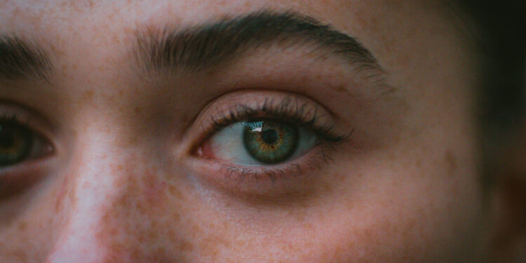 Poți scăpa de petele întunecate de pe ten