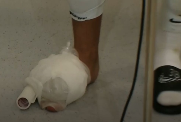 Imagini horror cu piciorul lui Mihai Lixandru. Cum a venit fotbalistul la flash-interviu