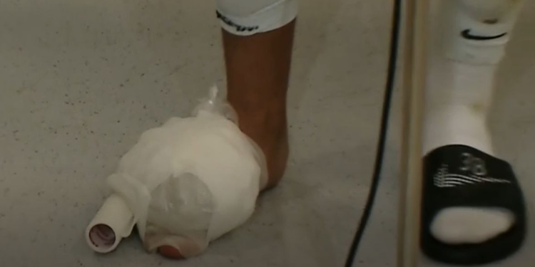 Imagini horror cu piciorul lui Mihai Lixandru. Cum a venit fotbalistul la flash-interviu