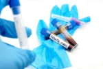 Alertă după repatrierea francezilor: unul dintre cei plasați în izolare strictă prezintă simptome de hantavirus